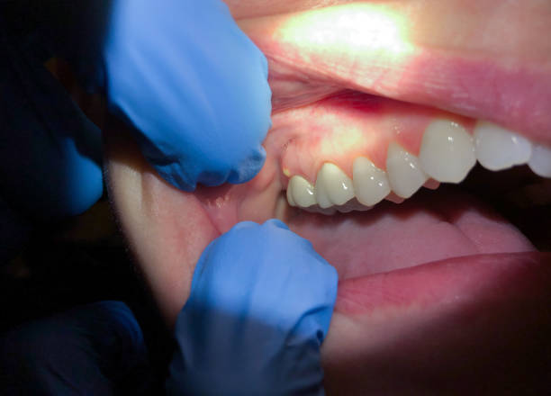 Best Emergency Dentist for Knocked-Out Tooth in Ashdown, AR